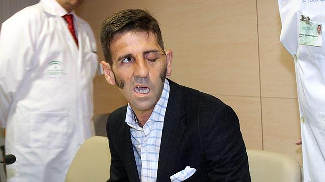Padilla: «Voy a luchar lo indecible por volver a torear»